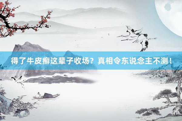 得了牛皮癣这辈子收场？真相令东说念主不测！